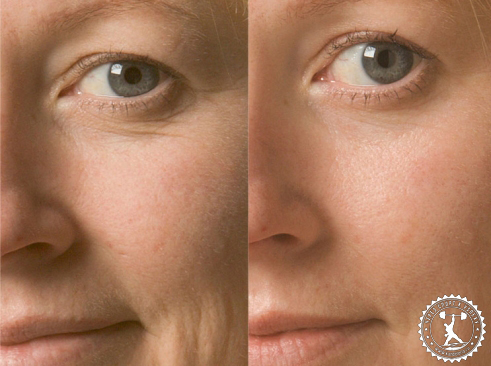 отзывы на эффективный крем от морщин вокруг глаз