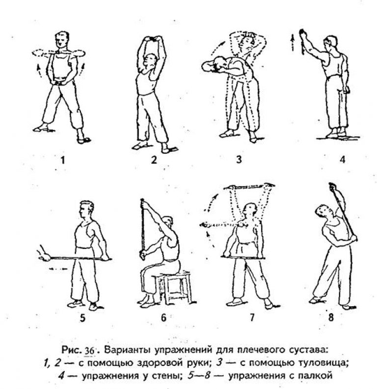 Лфк при переломе плеча комплекс упражнений в картинках