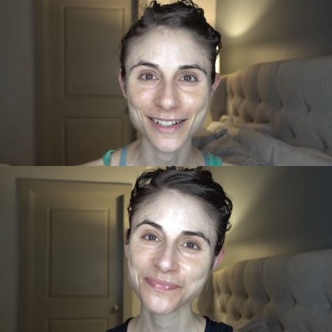 Фото до и после применения крема с мочевиной